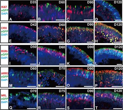 Generation of an RCVRN-eGFP Reporter hiPSC Line by CRISPR/Cas9 to Monitor Photoreceptor Cell Development and Facilitate the Cell Enrichment for Transplantation